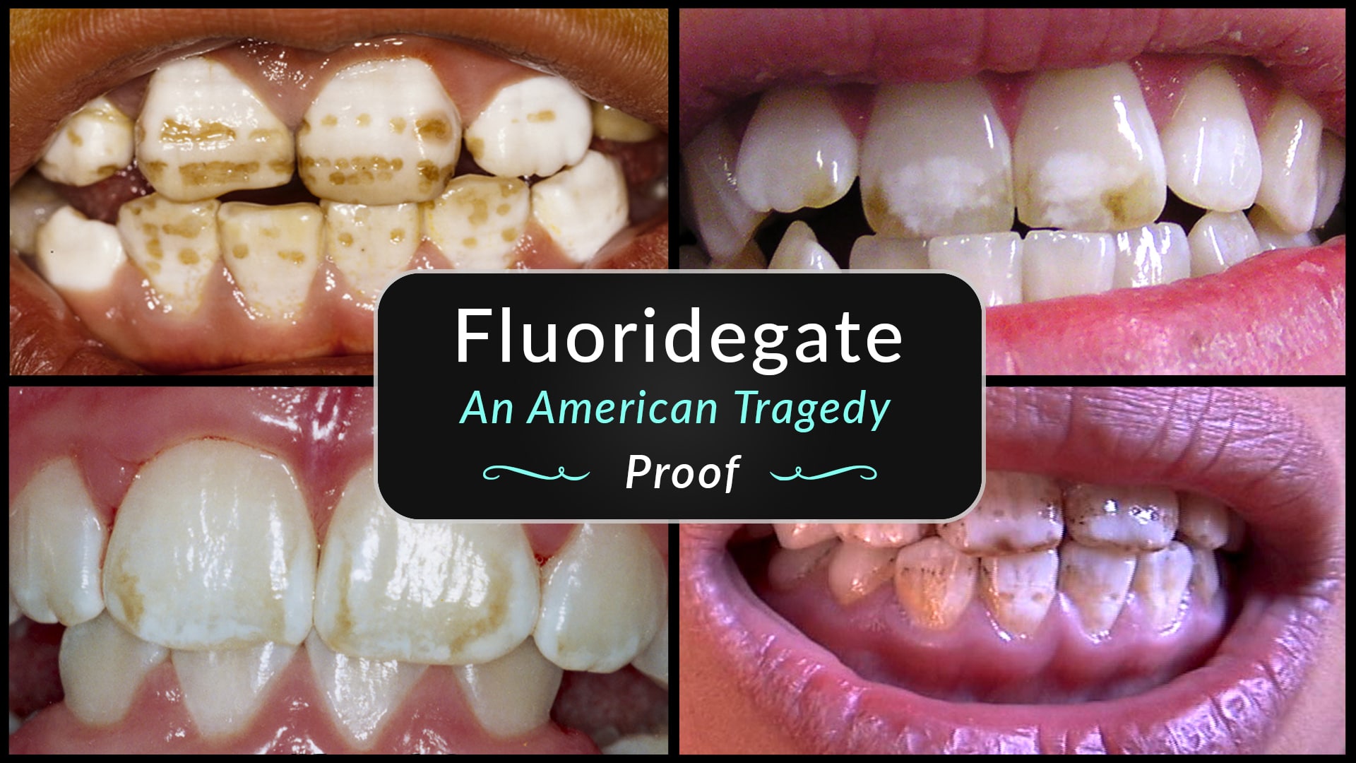 fluoridegate proof of harm