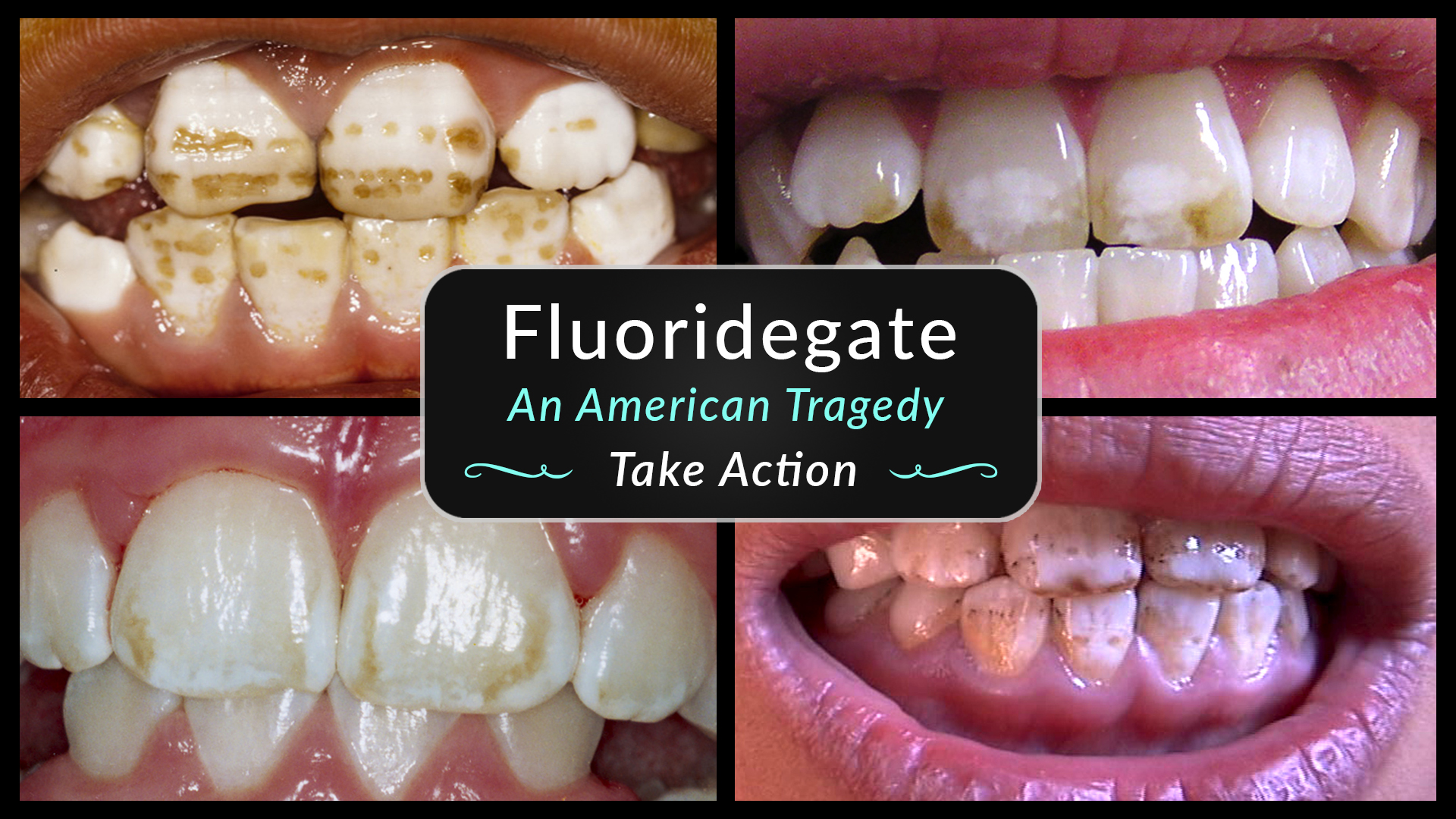 Take Action Against the use of Fluoride